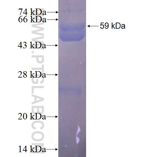 RACGAP1 fusion protein Ag4676 SDS-PAGE