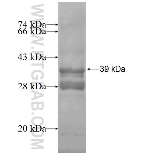RACGAP1 fusion protein Ag6944 SDS-PAGE