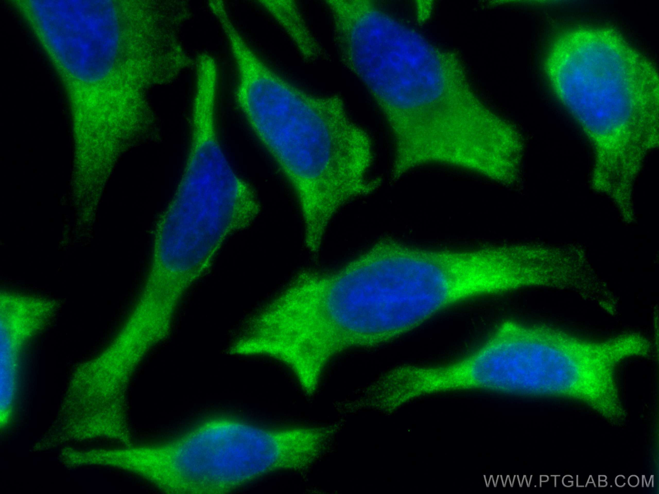 Immunofluorescence (IF) / fluorescent staining of HeLa cells using RACK1; GNB2L1 Monoclonal antibody (66940-1-Ig)