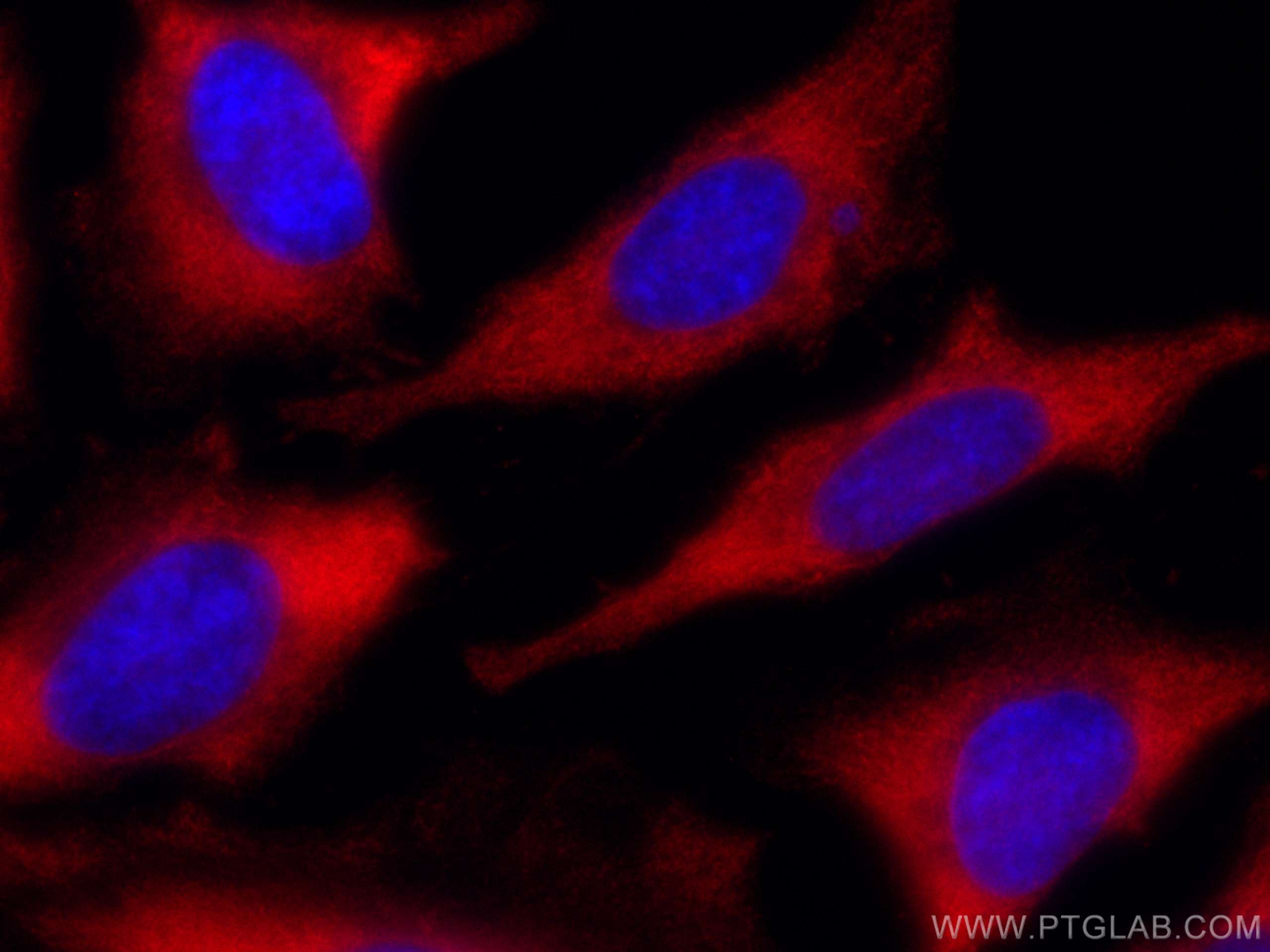 Immunofluorescence (IF) / fluorescent staining of HeLa cells using CoraLite®594-conjugated RACK1; GNB2L1 Monoclonal a (CL594-66940)