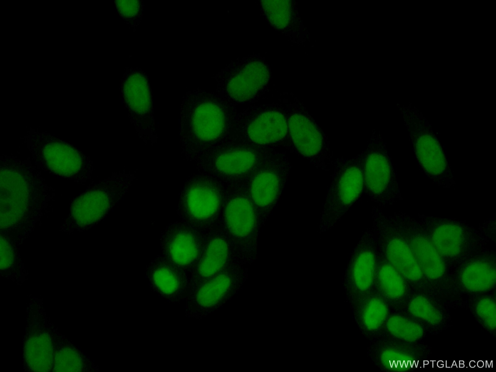 Immunofluorescence (IF) / fluorescent staining of HeLa cells using RAD1 Polyclonal antibody (11726-2-AP)