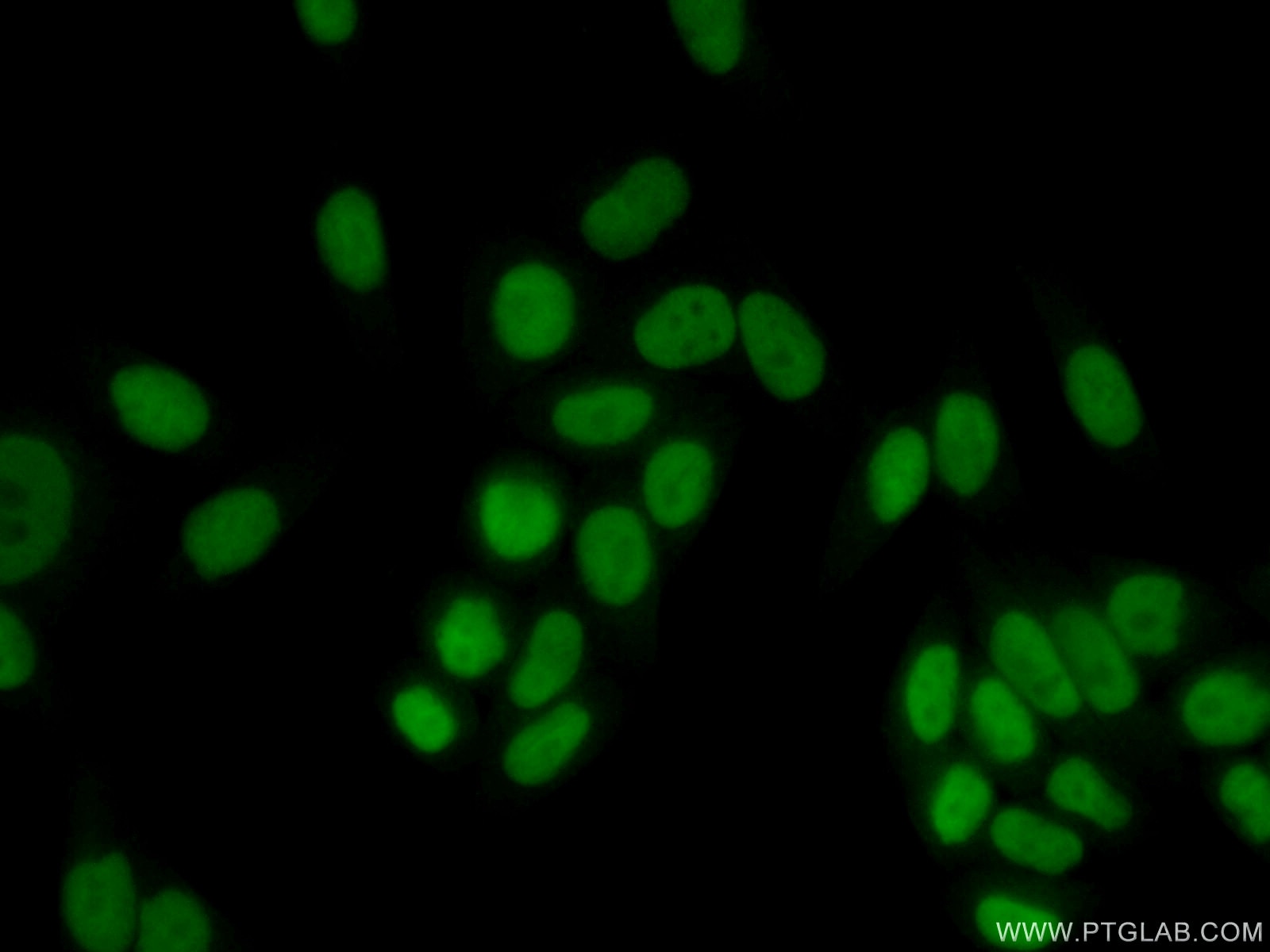 IF Staining of HeLa using 11726-2-AP