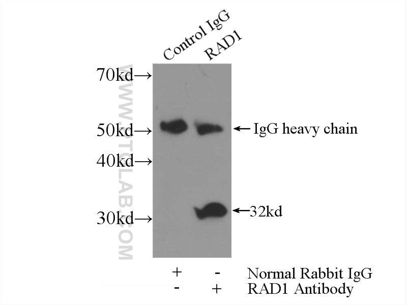 Immunoprecipitation (IP) experiment of HeLa cells using RAD1 Polyclonal antibody (11726-2-AP)