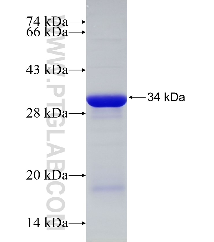 RAD1 fusion protein Ag33257 SDS-PAGE