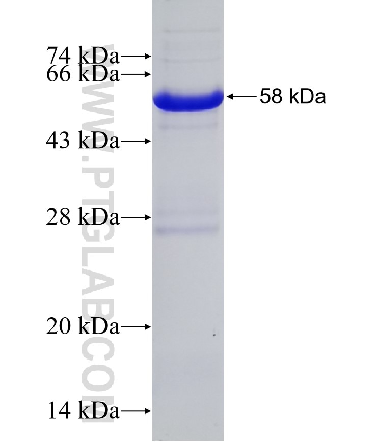RAD1 fusion protein Ag2316 SDS-PAGE