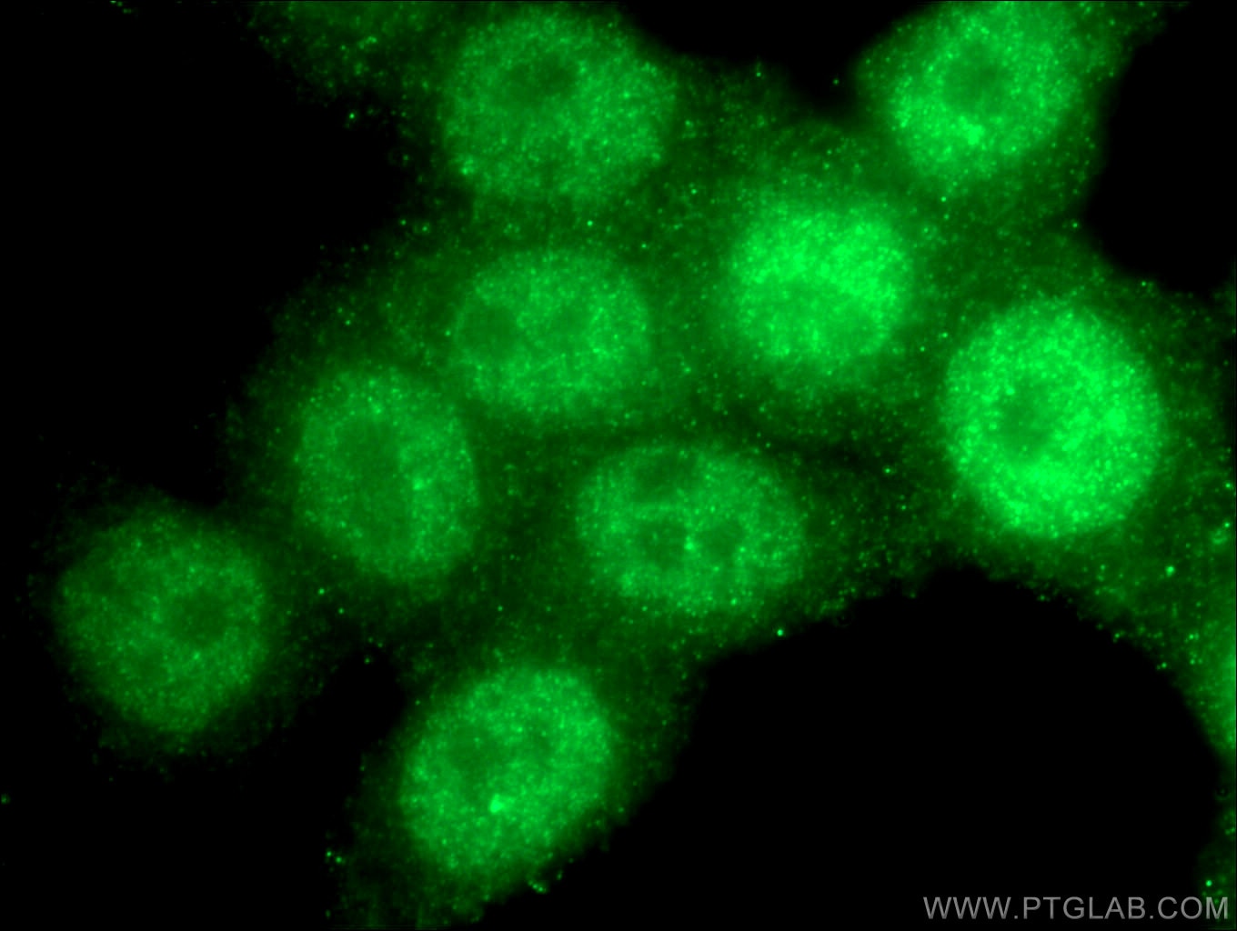 Immunofluorescence (IF) / fluorescent staining of HeLa cells using RAD17 Polyclonal antibody (13358-1-AP)