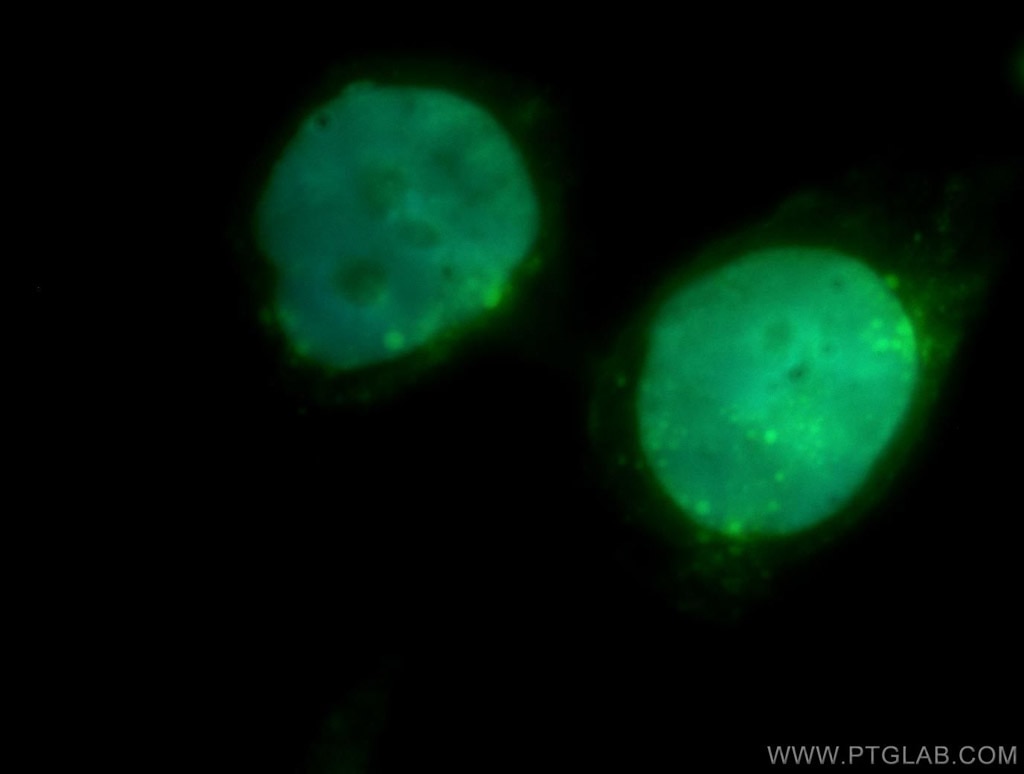 IF Staining of HeLa using 13358-1-AP