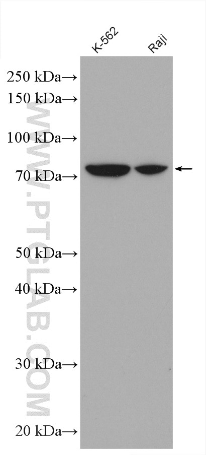 Western Blot (WB) analysis of various lysates using RAD17 Polyclonal antibody (13358-1-AP)