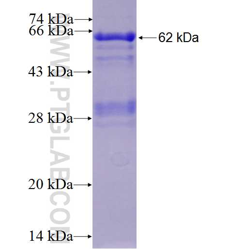 RAD17 fusion protein Ag4171 SDS-PAGE