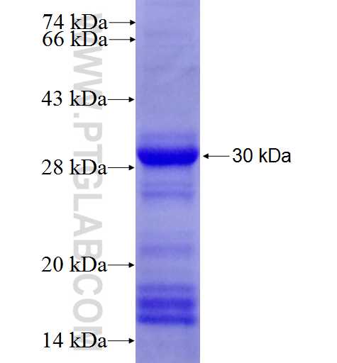 RAD17 fusion protein Ag4348 SDS-PAGE