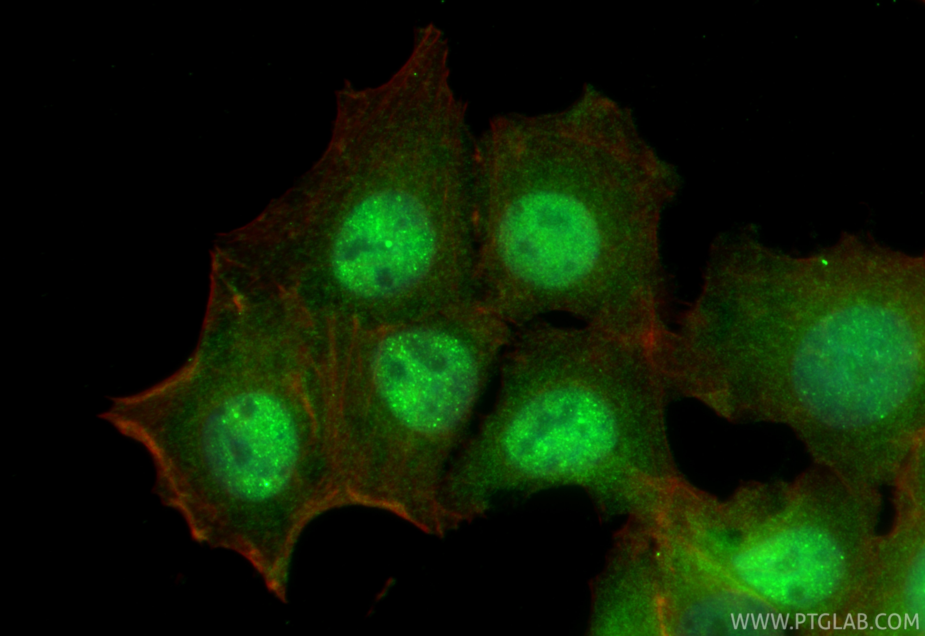 Immunofluorescence (IF) / fluorescent staining of MCF-7 cells using RAD18 Polyclonal antibody (18333-1-AP)