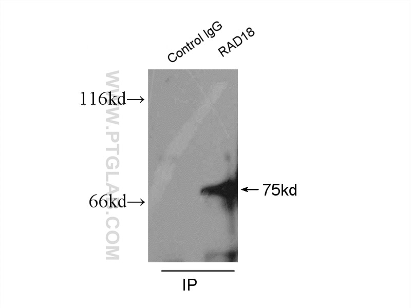 Immunoprecipitation (IP) experiment of K-562 cells using RAD18 Polyclonal antibody (18333-1-AP)