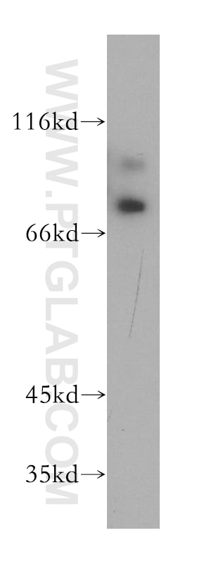Western Blot (WB) analysis of HeLa cells using RAD18 Polyclonal antibody (18333-1-AP)