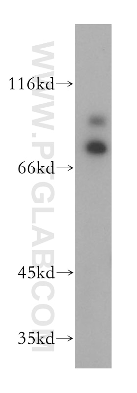 Western Blot (WB) analysis of MCF-7 cells using RAD18 Polyclonal antibody (18333-1-AP)