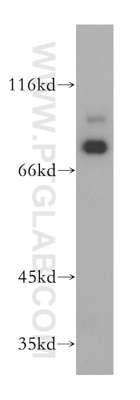 Western Blot (WB) analysis of K-562 cells using RAD18 Polyclonal antibody (18333-1-AP)