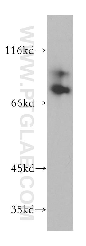 Western Blot (WB) analysis of A549 cells using RAD18 Polyclonal antibody (18333-1-AP)