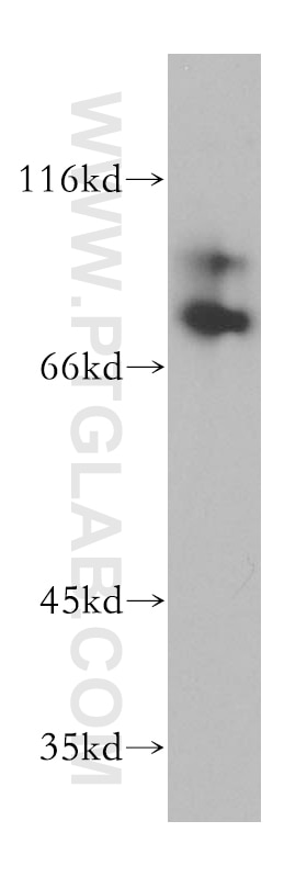 WB analysis of A549 using 18333-1-AP