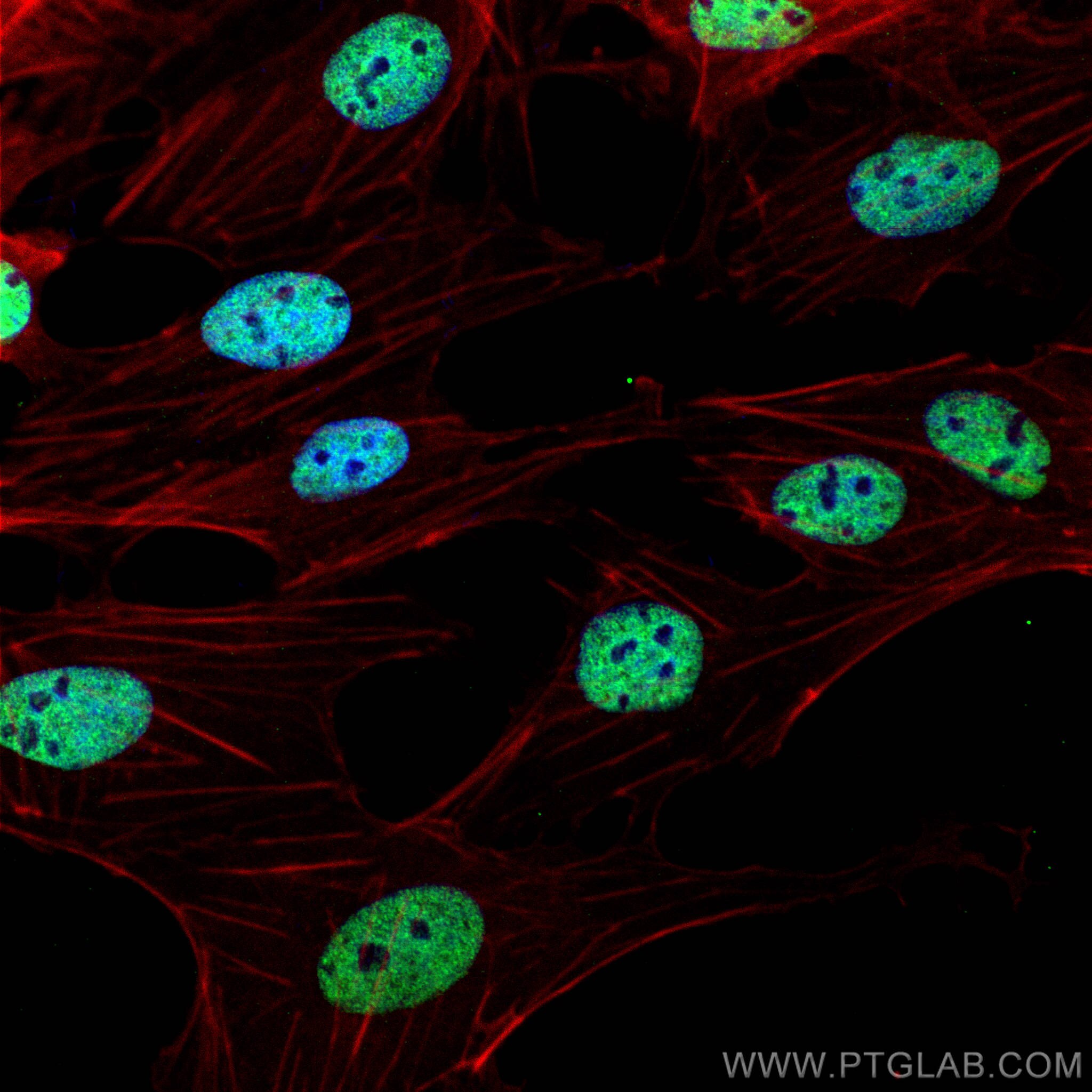 IF Staining of MDCK using 27071-1-AP