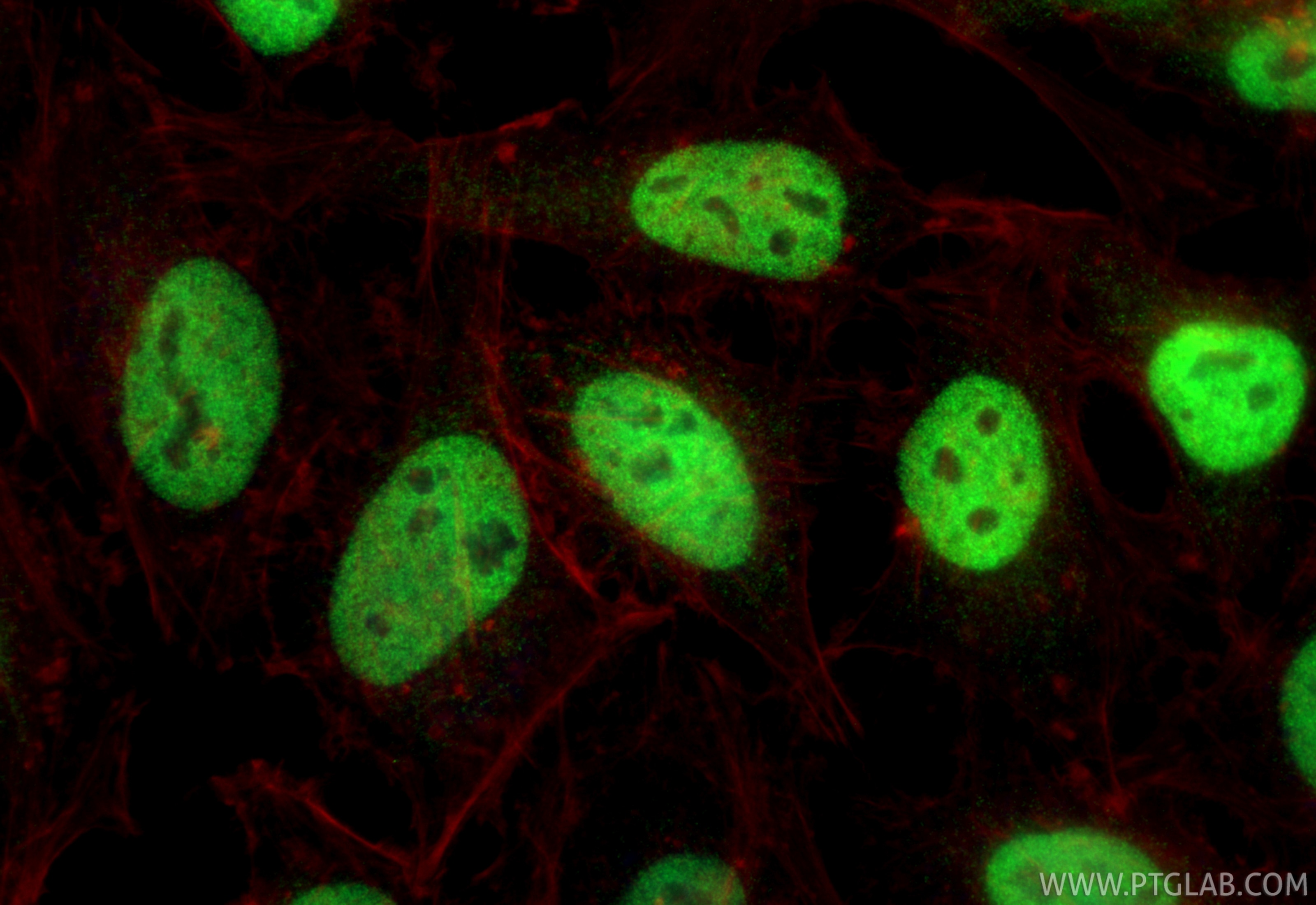 Immunofluorescence (IF) / fluorescent staining of HeLa cells using RAD21 Polyclonal antibody (27071-1-AP)