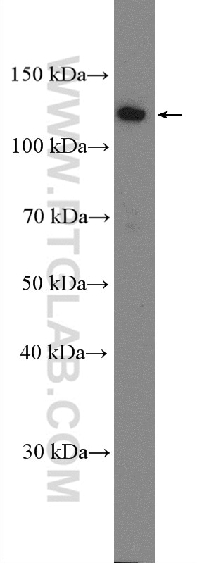 Western Blot (WB) analysis of A549 cells using RAD21 Polyclonal antibody (27071-1-AP)