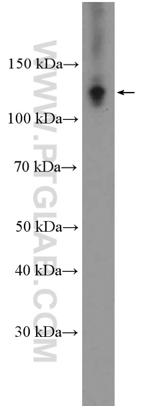 Western Blot (WB) analysis of HeLa cells using RAD21 Polyclonal antibody (27071-1-AP)