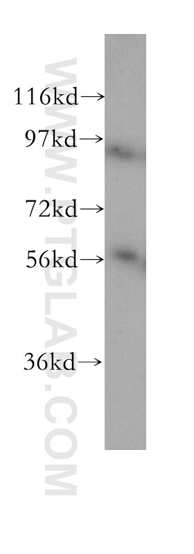 Western Blot (WB) analysis of mouse testis tissue using RAD23A Polyclonal antibody (11364-1-AP)