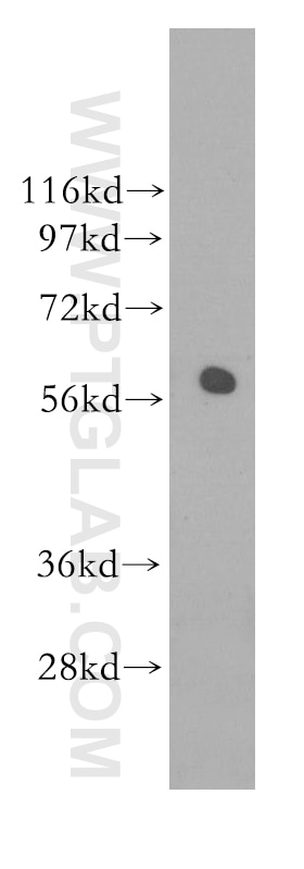 Western Blot (WB) analysis of mouse testis tissue using RAD23A Polyclonal antibody (11364-1-AP)