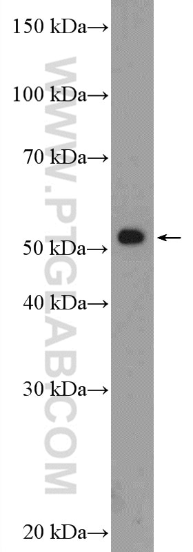 Western Blot (WB) analysis of mouse spleen tissue using RAD23A Polyclonal antibody (51033-1-AP)