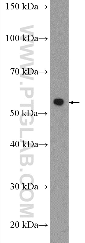 Western Blot (WB) analysis of rat spleen tissue using RAD23A Polyclonal antibody (51033-1-AP)
