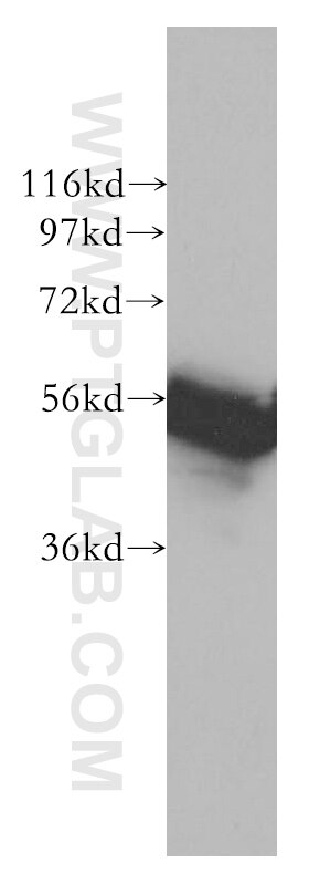 Western Blot (WB) analysis of Jurkat cells using RAD23A Polyclonal antibody (51033-1-AP)