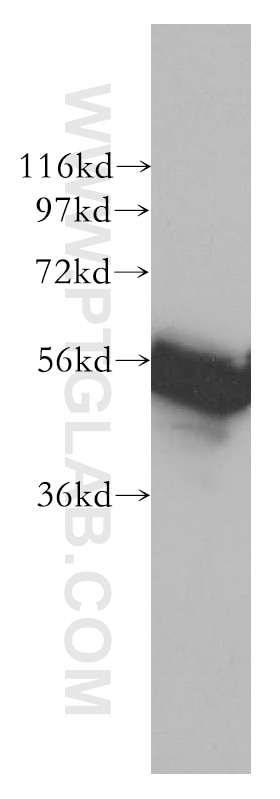WB analysis of Jurkat using 51033-1-AP