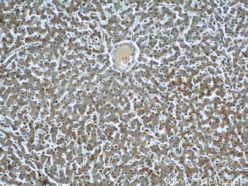 Immunohistochemistry (IHC) staining of human liver tissue using RAD23B Polyclonal antibody (12121-1-AP)