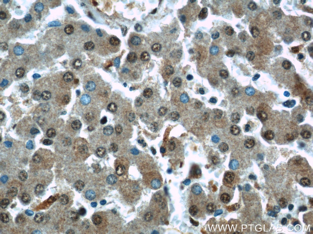 Immunohistochemistry (IHC) staining of human liver tissue using RAD23B Polyclonal antibody (12121-1-AP)