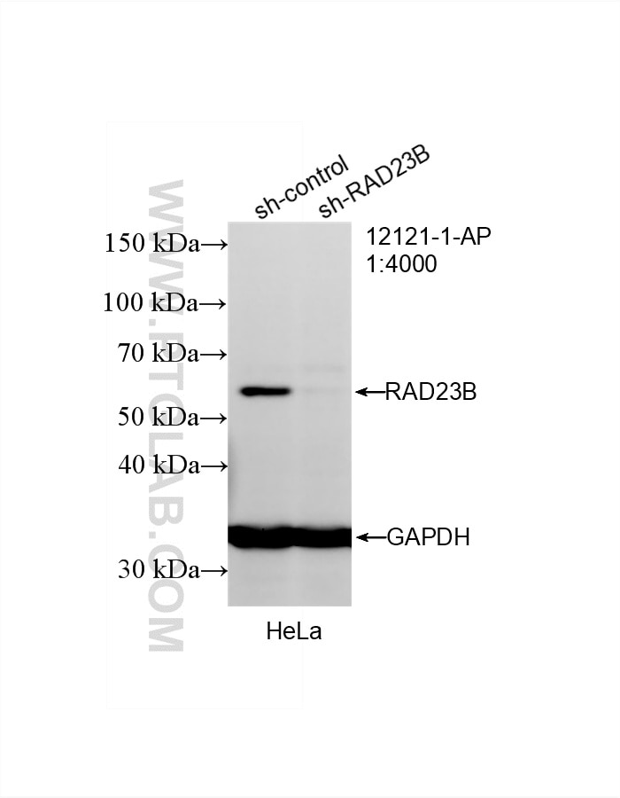 Western Blot (WB) analysis of HeLa cells using RAD23B Polyclonal antibody (12121-1-AP)