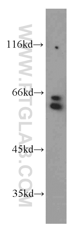 Western Blot (WB) analysis of Jurkat cells using RAD23B Polyclonal antibody (12121-1-AP)
