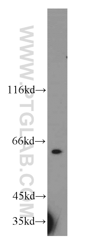 Western Blot (WB) analysis of HEK-293 cells using RAD23B Polyclonal antibody (12121-1-AP)