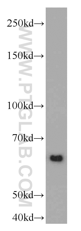 Western Blot (WB) analysis of A431 cells using RAD23B Polyclonal antibody (12121-1-AP)