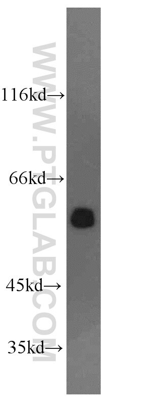 Western Blot (WB) analysis of Jurkat cells using RAD23B Polyclonal antibody (12121-1-AP)