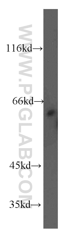 Western Blot (WB) analysis of mouse kidney tissue using RAD23B Polyclonal antibody (12121-1-AP)