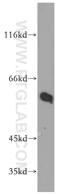 Western Blot (WB) analysis of A431 cells using RAD23B Polyclonal antibody (12121-1-AP)