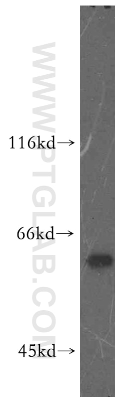 Western Blot (WB) analysis of HEK-293 cells using RAD23B Polyclonal antibody (12121-1-AP)