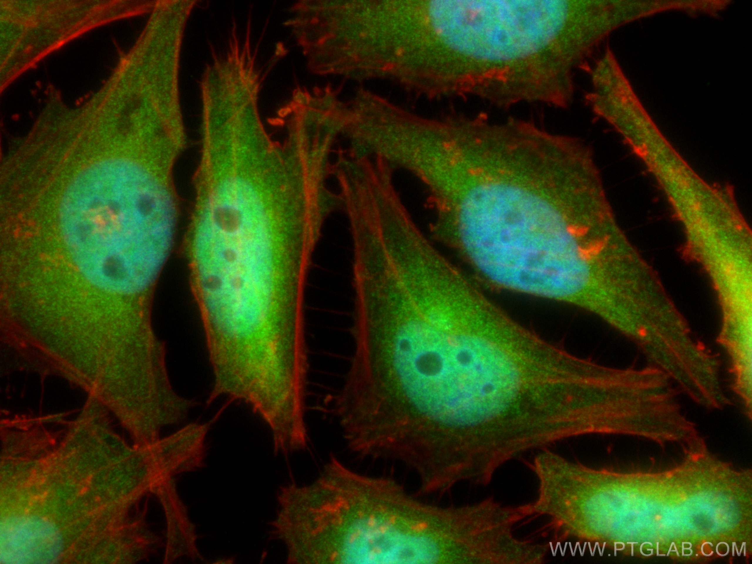 Immunofluorescence (IF) / fluorescent staining of HeLa cells using RAD23B Monoclonal antibody (67988-1-Ig)