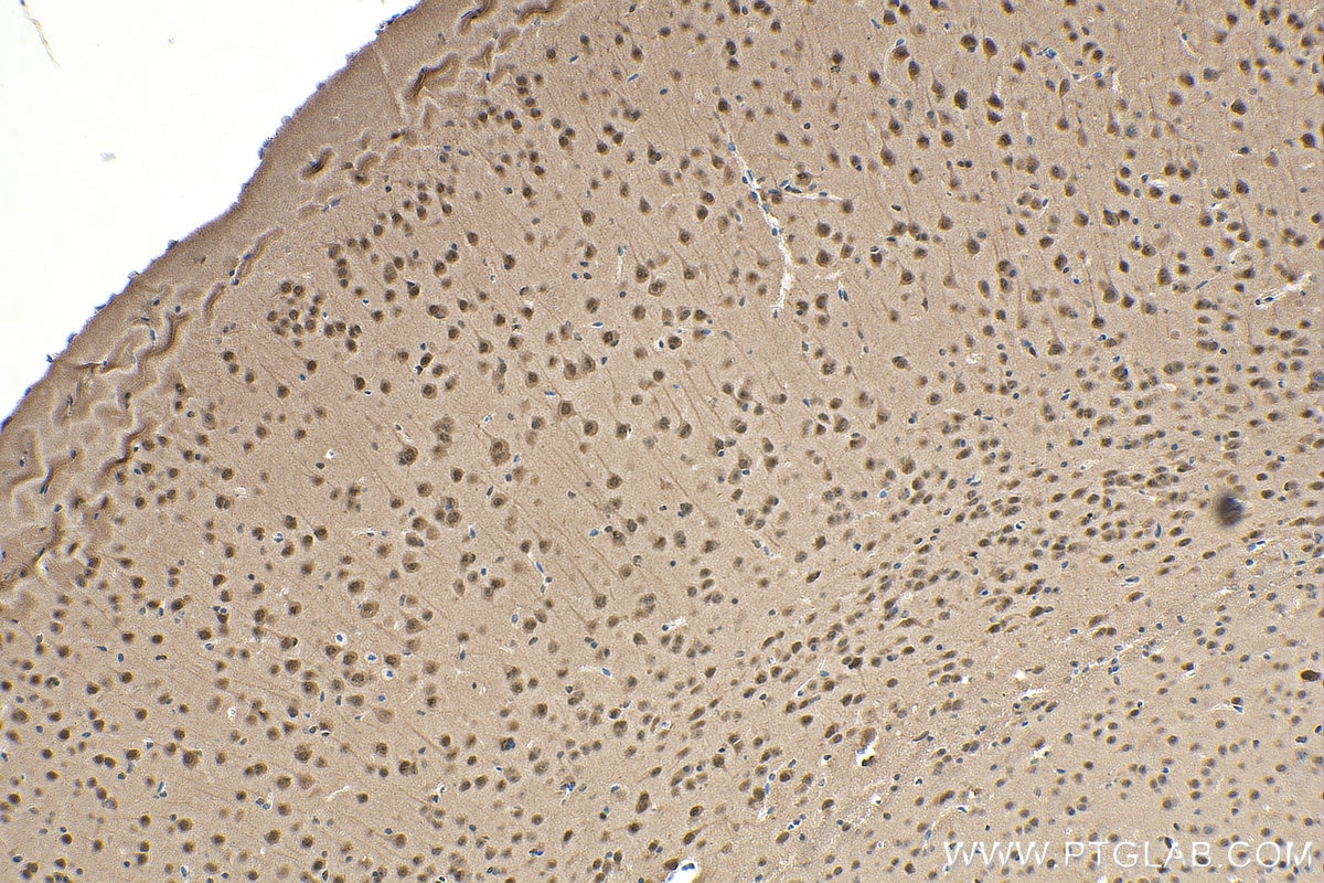 Immunohistochemistry (IHC) staining of mouse brain tissue using RAD23B Monoclonal antibody (67988-1-Ig)
