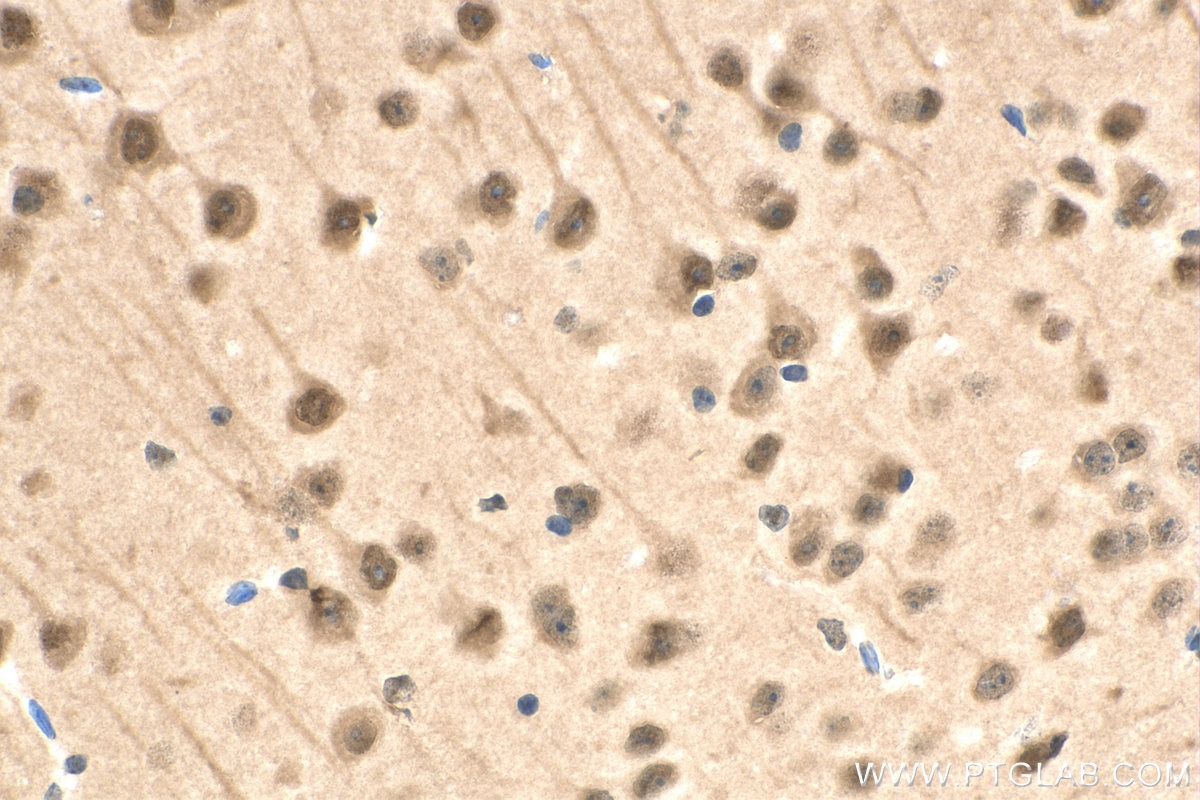 IHC staining of mouse brain using 67988-1-Ig