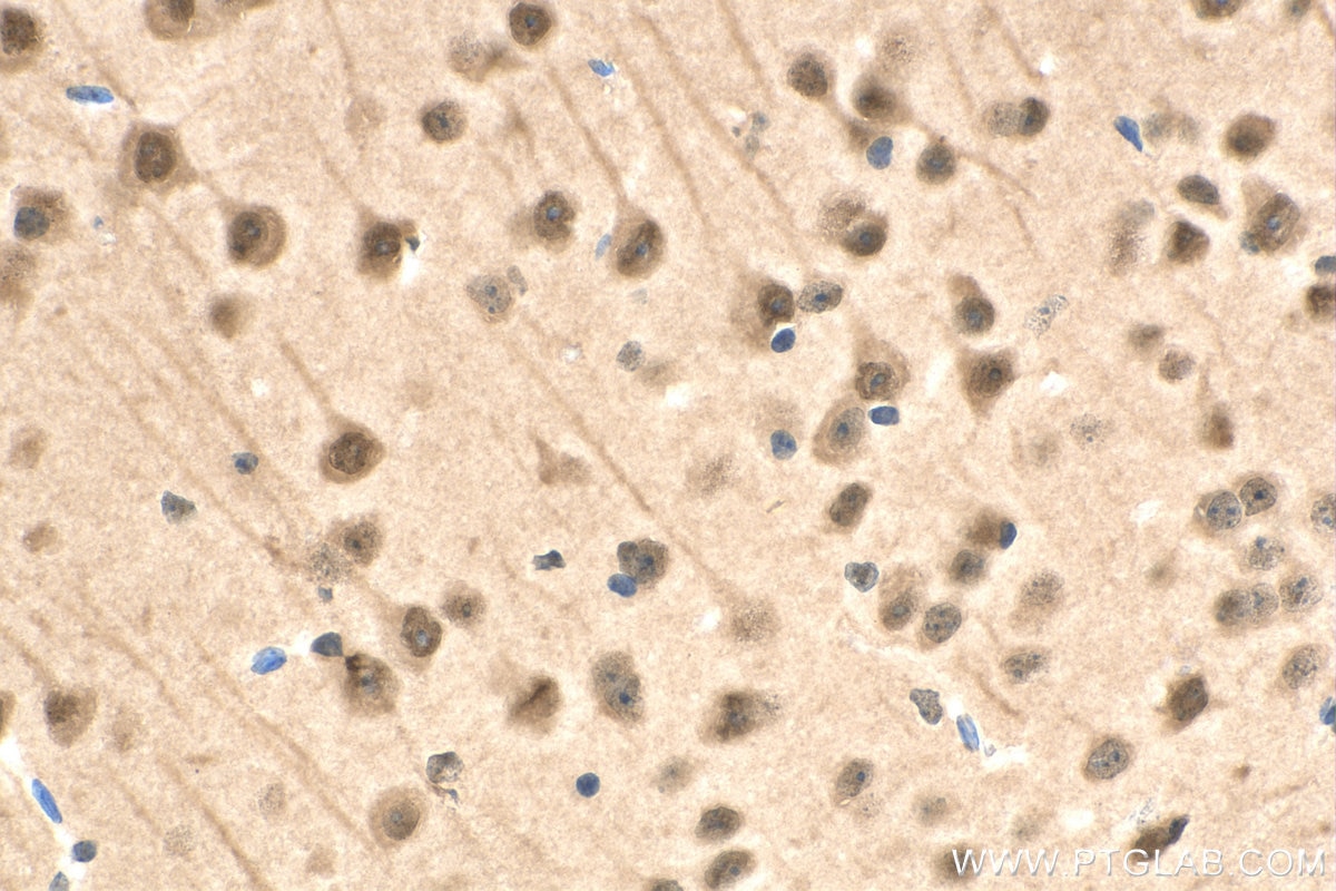 Immunohistochemistry (IHC) staining of mouse brain tissue using RAD23B Monoclonal antibody (67988-1-Ig)