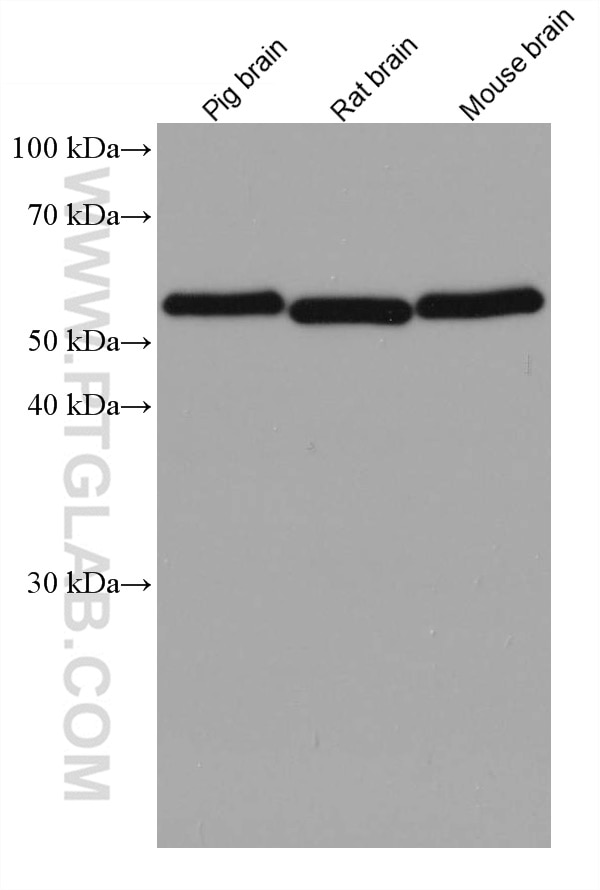 Western Blot (WB) analysis of various lysates using RAD23B Monoclonal antibody (67988-1-Ig)
