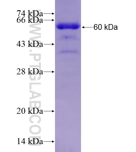 RAD23B fusion protein Ag28658 SDS-PAGE