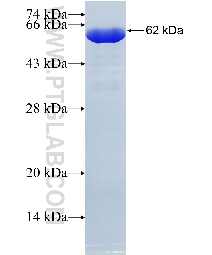 RAD23B fusion protein Ag28658 SDS-PAGE