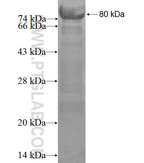 RAD23B fusion protein Ag2763 SDS-PAGE