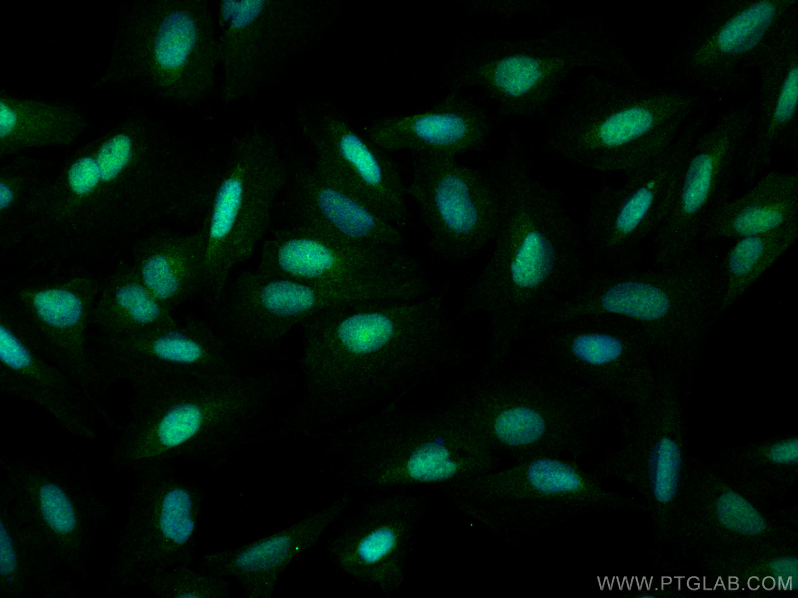 Immunofluorescence (IF) / fluorescent staining of U2OS cells using RAD50 Polyclonal antibody (29390-1-AP)